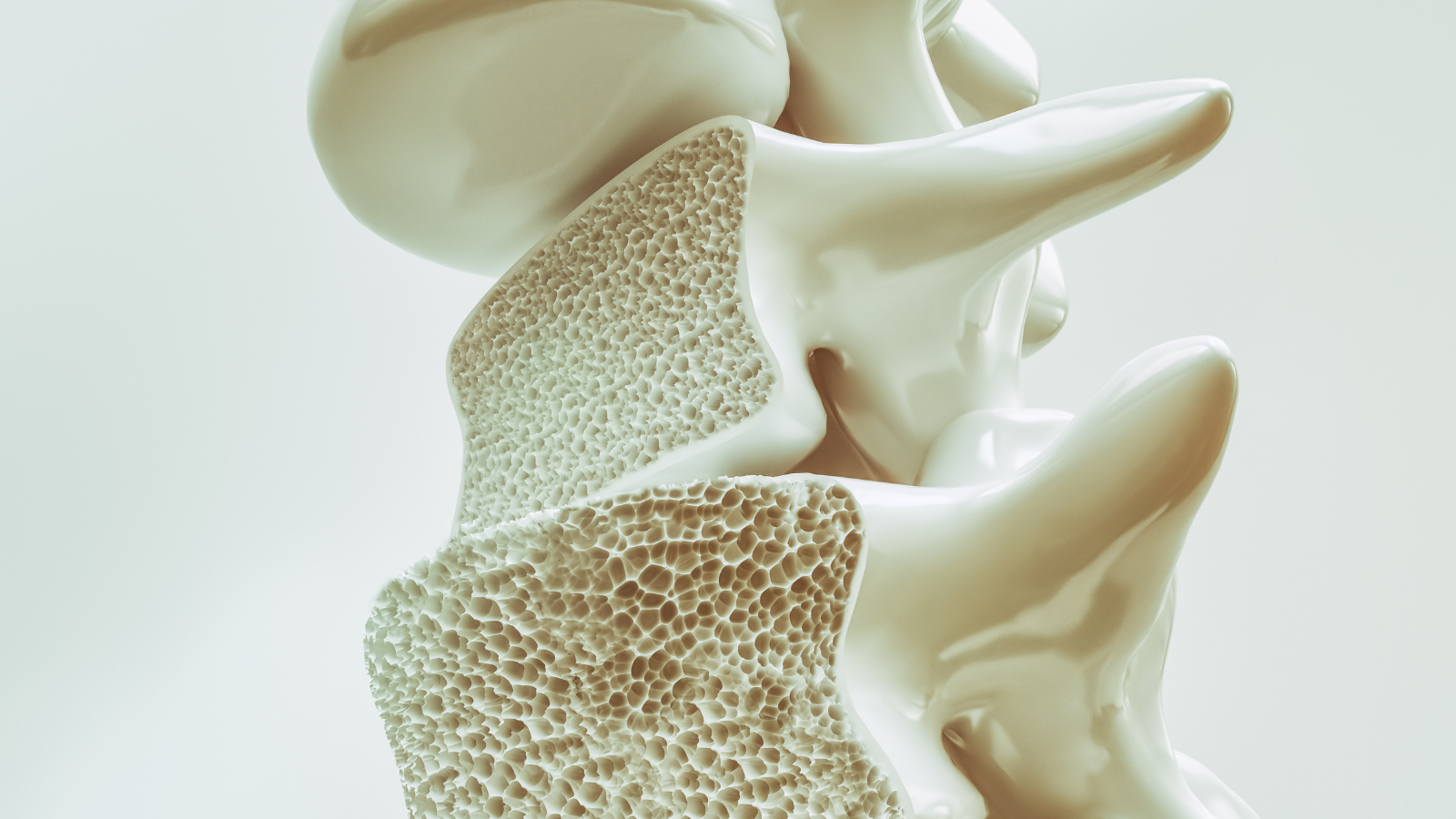 Osteoporosis
