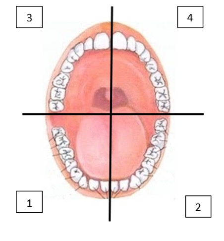Limpieza bucodental